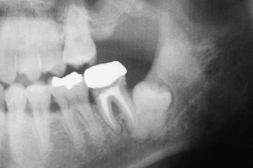 親知らずの抜歯は経験豊富な歯科医師が担当します